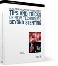Tips and tricks of new techniques beyond stenting