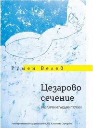 Цезарово сечение. Различни гледни точки