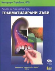 Лечебно планиране при травматизирани зъби