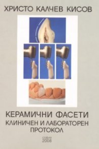 Керамични фасети. Клиничен и лабораторен протокол