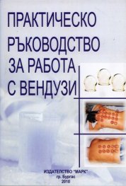 Практическо ръководство за работа с вендузи