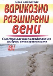 Варикозно разширени вени