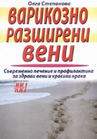 Варикозно разширени вени